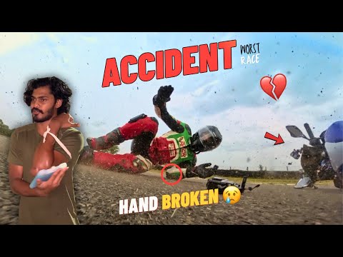 Thumbnail for 😭Accident My hand broken💔|Again and again | I give up this time | TTF | Tamil | 