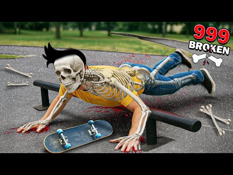 Thumbnail for I Broke Multiple BONES While Skateboarding 💥