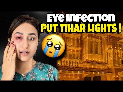 Thumbnail for MY EYE GOT INFECTED RIGHT BEFORE THE TRIP 😭 SO SCARED NOW 💔