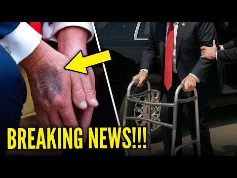 Thumbnail for Trump is "TERMINAL" and Been Given a "TIMELINE"